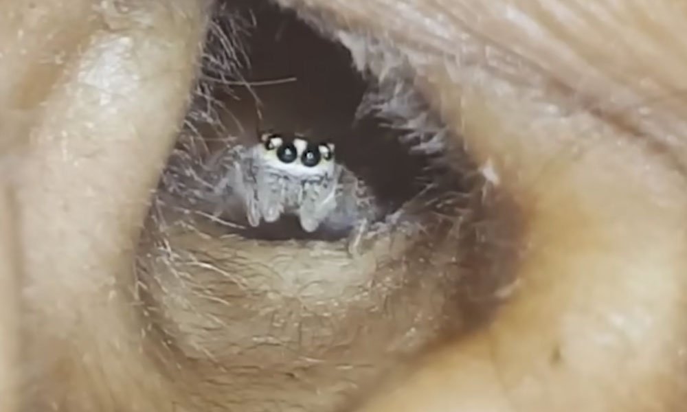 Spider in woman's ear