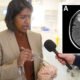 Live worm found in woman's brain