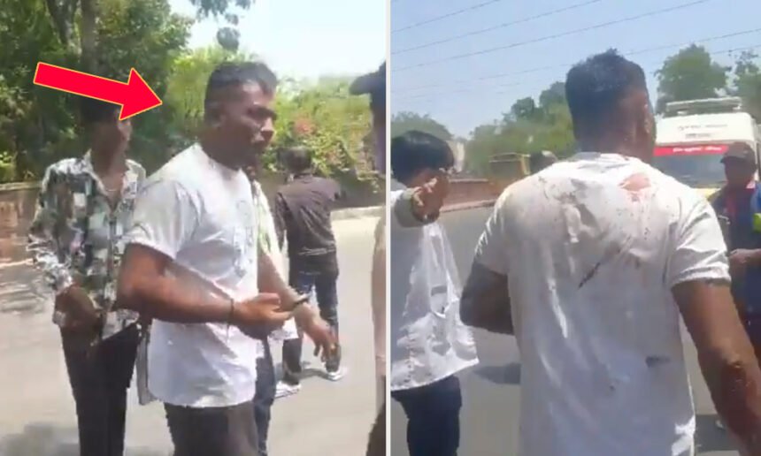 Miracle Survivor Emerges From Ahmedabad Plane Wreckage, Walks to Ambulance