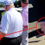 Trump Now Has Bruises on Both Hands as Health Questions Intensify