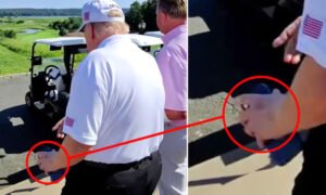 Trump Now Has Bruises on Both Hands as Health Questions Intensify