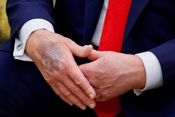 Speculation Erupts Online After Video Alleges Trump Suffering from Congestive Heart Failure, Could Die Within Months