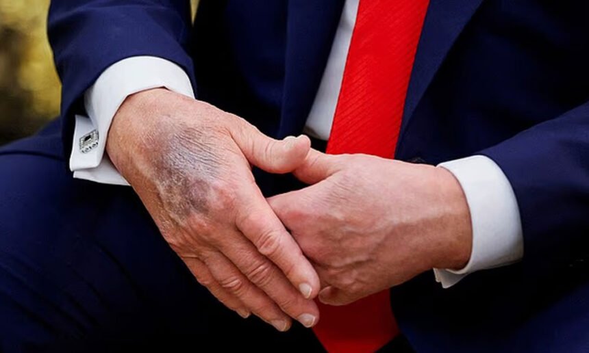 Speculation Erupts Online After Video Alleges Trump Suffering from Congestive Heart Failure, Could Die Within Months