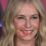 Dentists Sound Alarm on 'Ozempic Teeth' After Disturbing Side Effects Reported