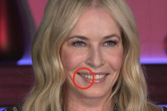 Dentists Sound Alarm on 'Ozempic Teeth' After Disturbing Side Effects Reported